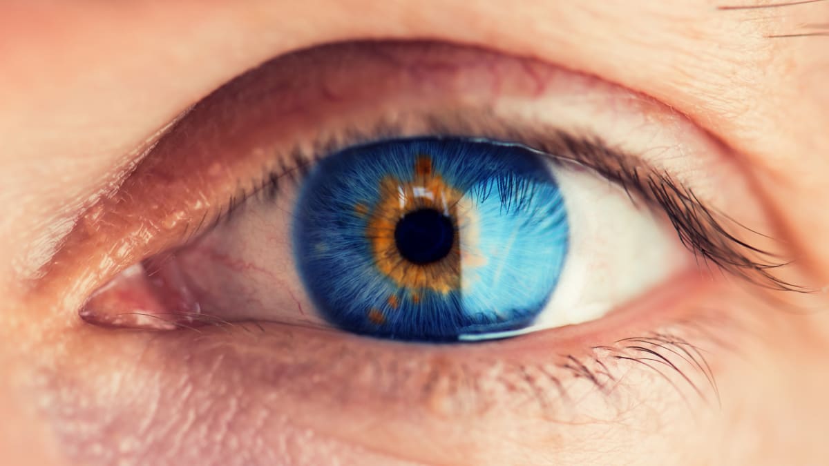 Co dokáže odhalit oční bělmo o vašem zdraví?
