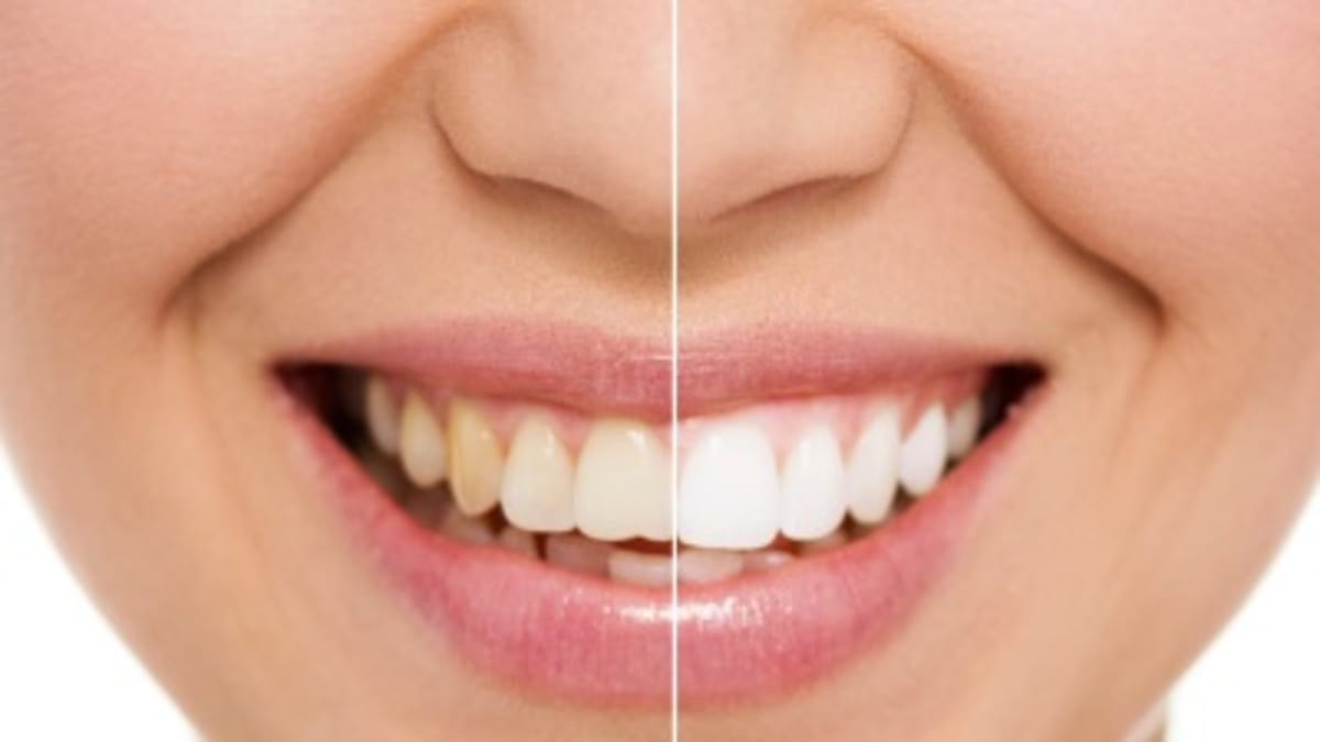 Zdravé a krásné zuby vám nejen dodají sebevědomí, ale také rozhodují o celkovém zdraví organismu