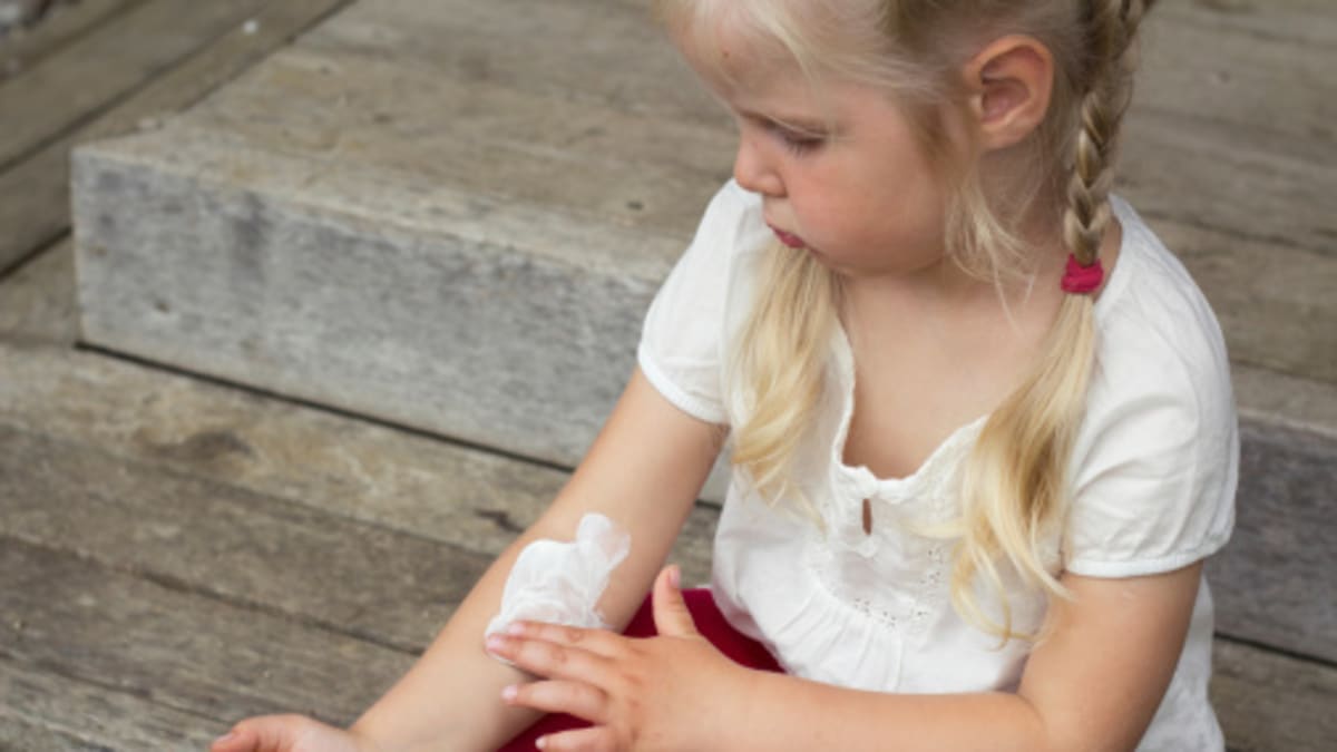 Ne všechny hypoalergenní krémy jsou pro děti s atopickým ekzémem vhodné
