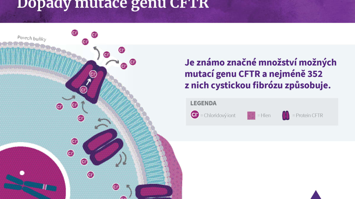Dopady mutace genu CFTR