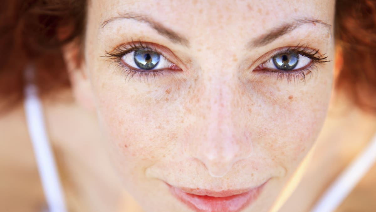 8 příčin rakoviny kůže, které vás mohou překvapit