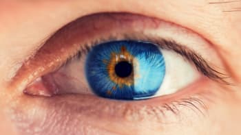 Co dokáže odhalit oční bělmo o vašem zdraví? Může jít o banalitu nebo i vážnější problém