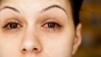 10 problémů s očima, které se nevyplatí podceňovat