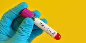 Do Česka dorazilo 211 HIV pozitivních Ukrajinců. Laboratoře obavy z nákazy krotí