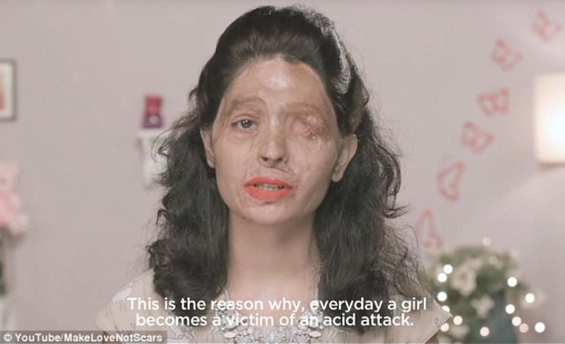 Reshma má znetvořený obličej kyselinou - Obrázek 1