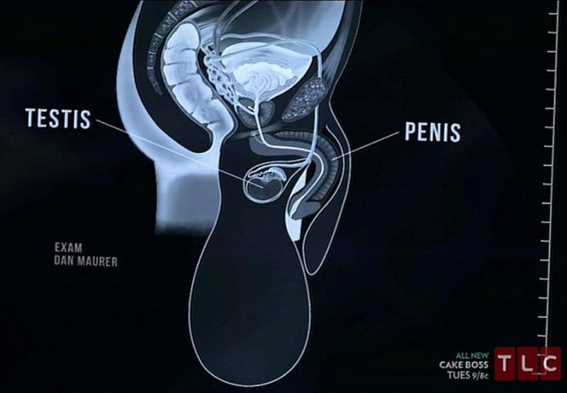 Snímek jeho penisu