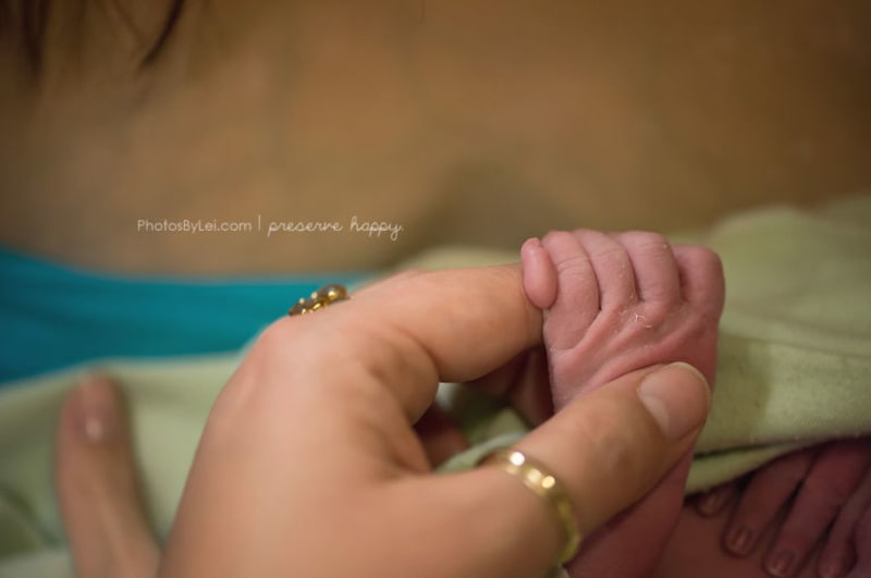 Rarita a velké překvapení pro maminku i celý porodní tým - miminko se narodilo s šesti prsty.