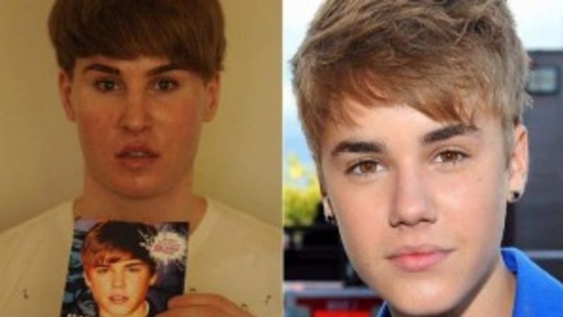Utratil 73000 € (1 972 492kč), aby vypadal jako Justin Bieber. Tohle je výsledek