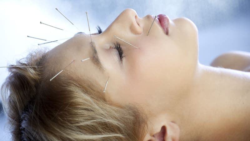 Kosmetická akupunktura: Jak vám mohou pomoci jehly bez chemie?