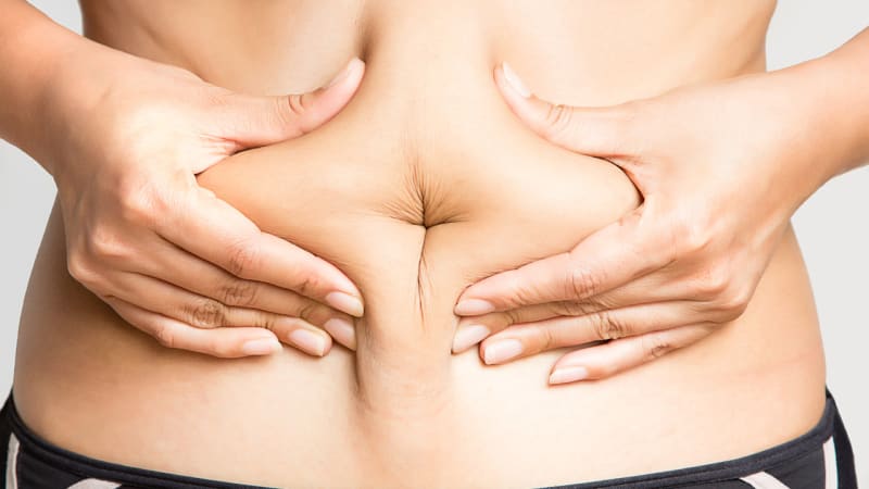 5 největších mýtů o liposukci: Nevěřte lákavým reklamám