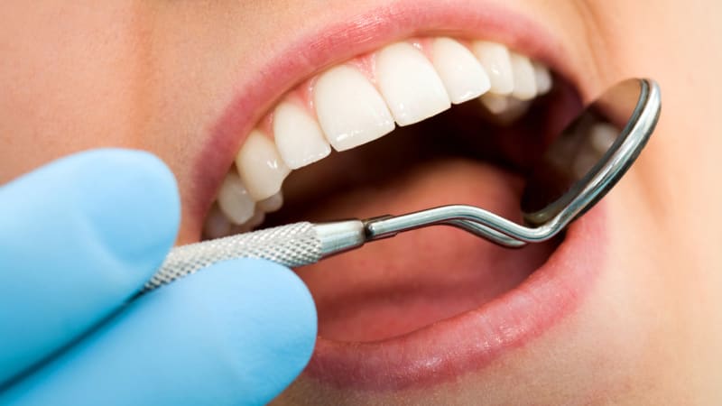 12 věcí, které zubař vyčte z vašich úst