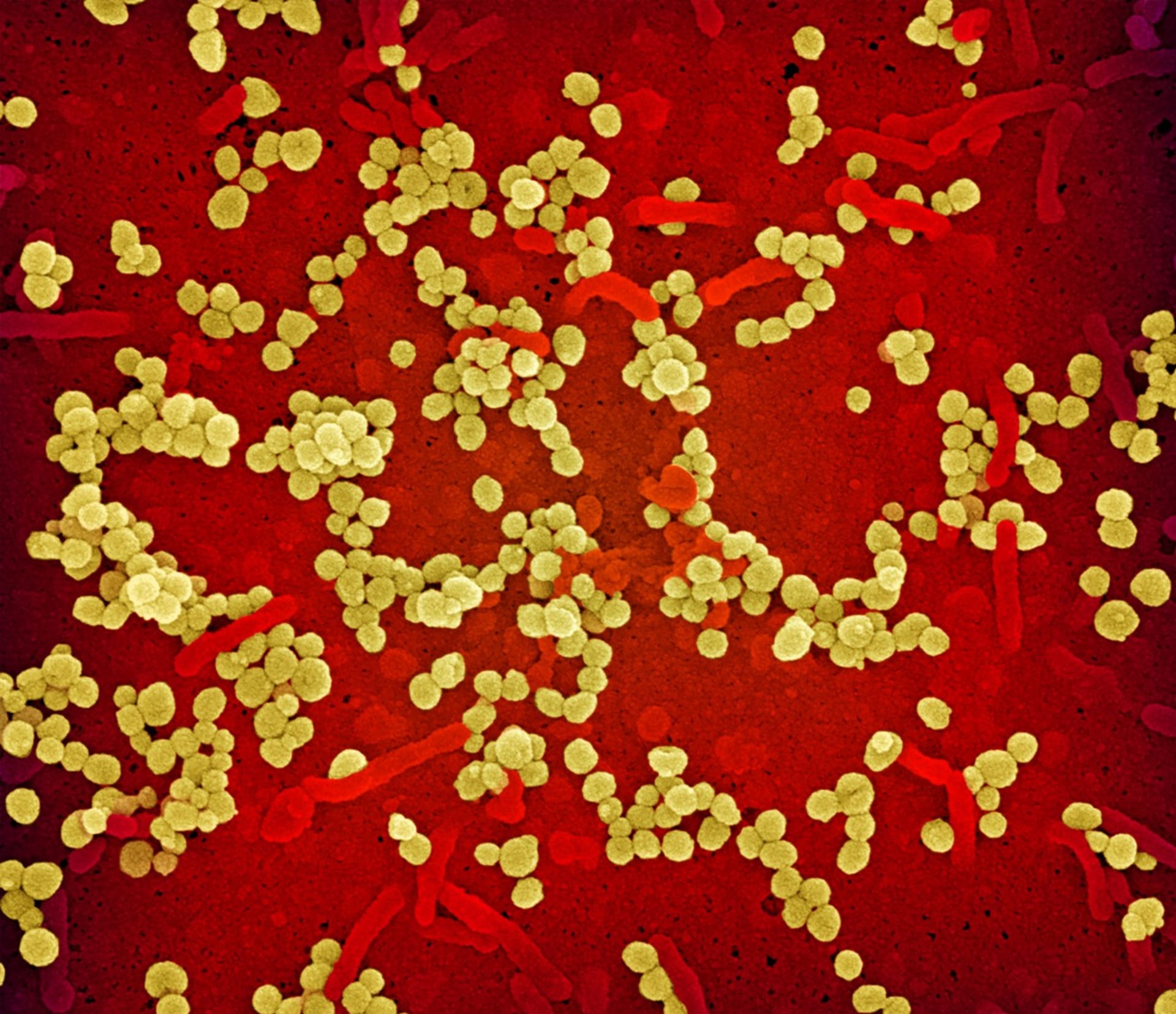 Virus Lassa způsobuje krvácivou horečkou
