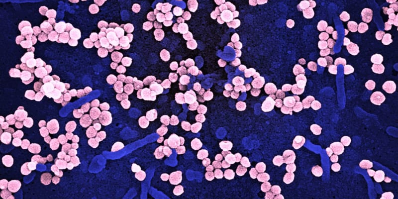 Virus Lassa způsobí nebezpečnou nemoc jen v pětině případů.