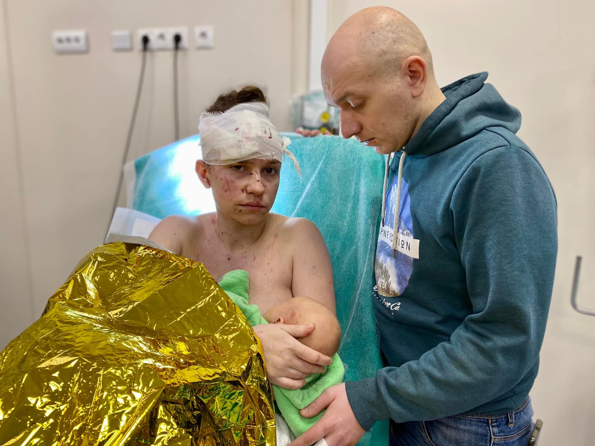 Olga a Dmitrij v nemocnici, kde skončili po bombardování. Matka kryla dítě vlastním tělem. (18.3.2022)