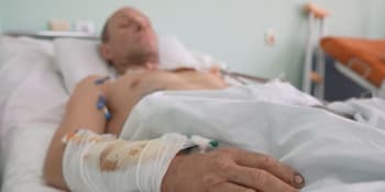 Štáb CNN z ukrajinské nemocnice: Desítky lékařů daly výpověď, nedokázaly čelit traumatu