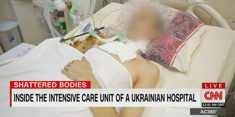 Štáb CNN navštívil jednu z ukrajinských nemocnic.