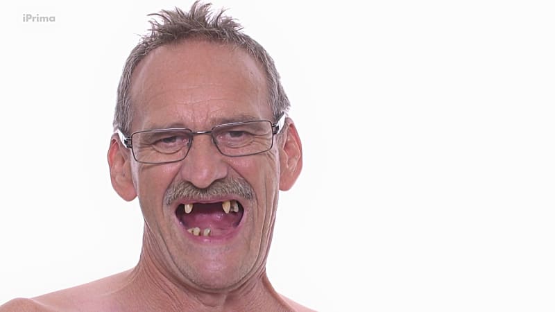 Rudolf (57) měl před proměnou v ústech jen čtyři zuby
