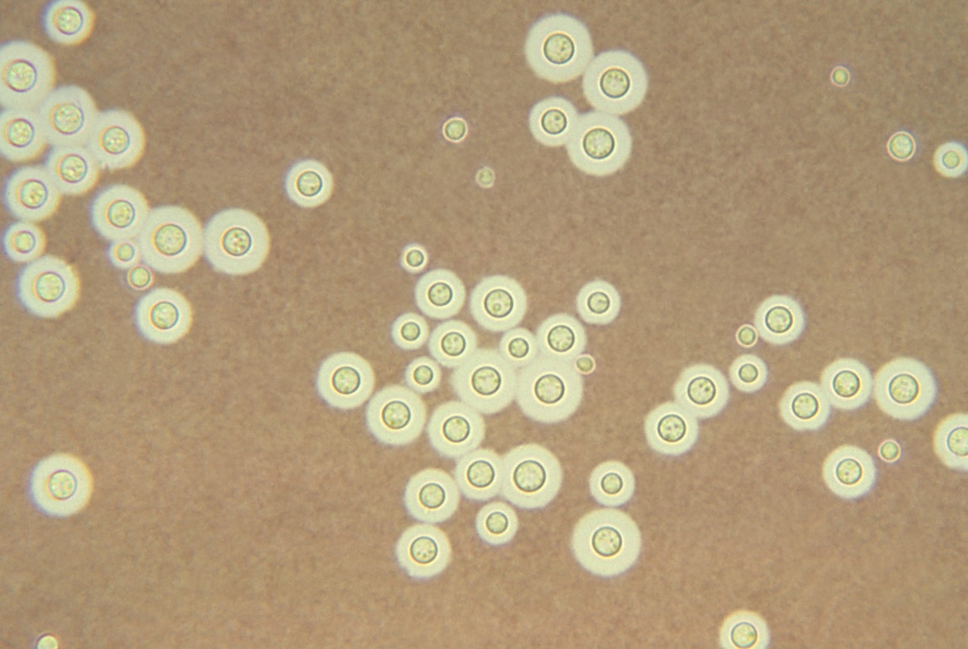Mikroskopické houby druhu Cryptococcus neoformans (zde obarvené světlým indickým inkoustem)