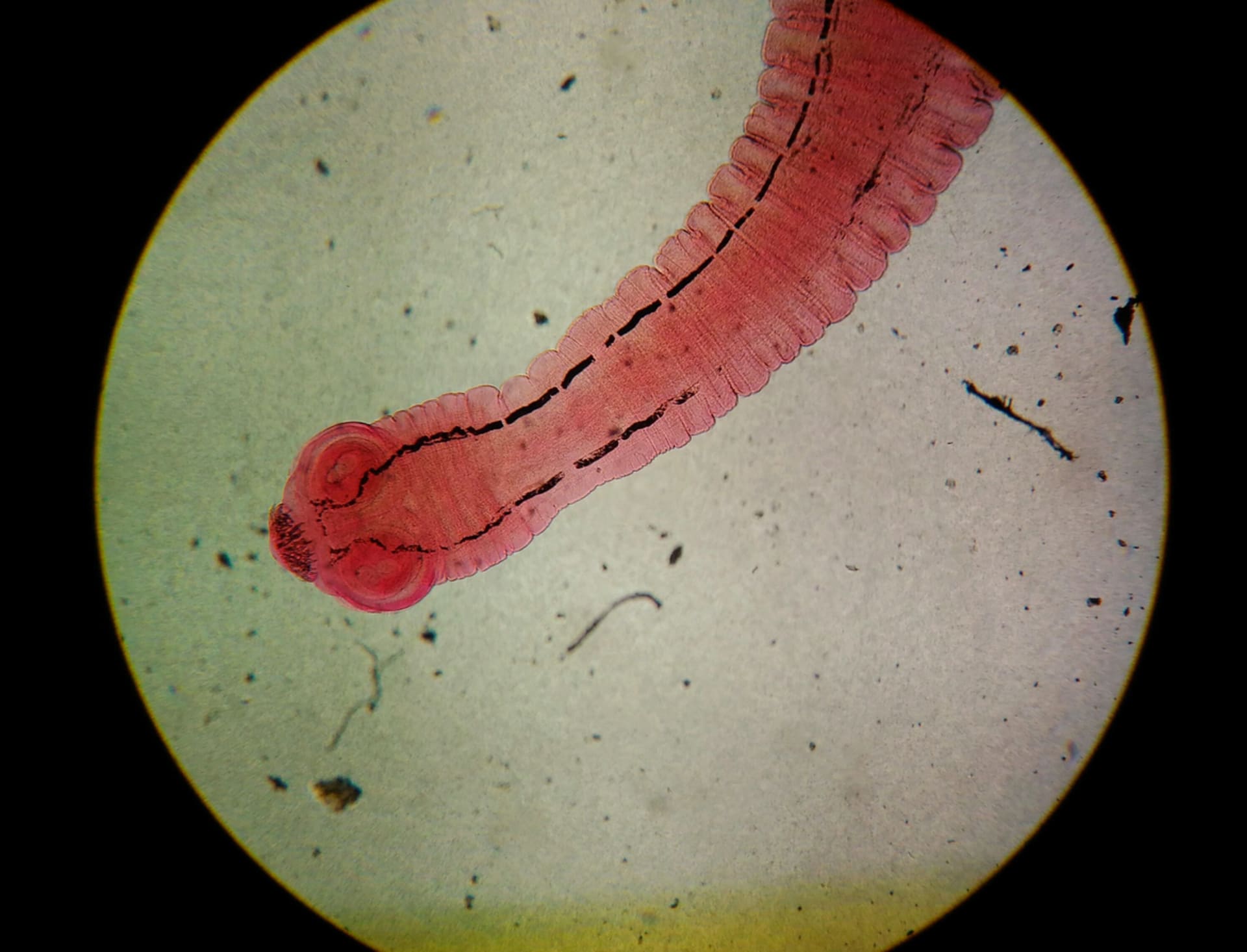 Parazit pod mikroskopem