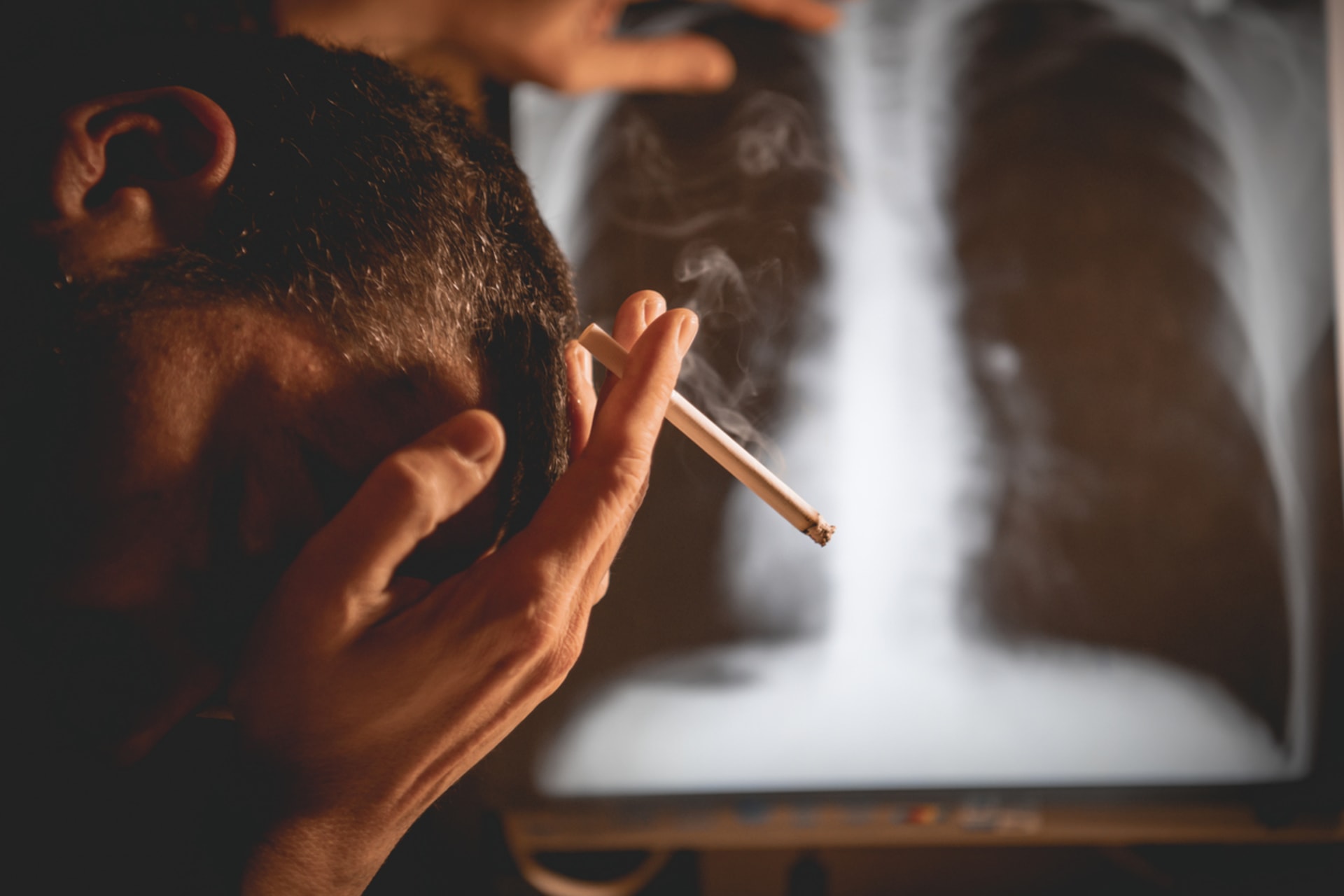 Rakovina plic je diagnóza, která děsí většinu kuřáků