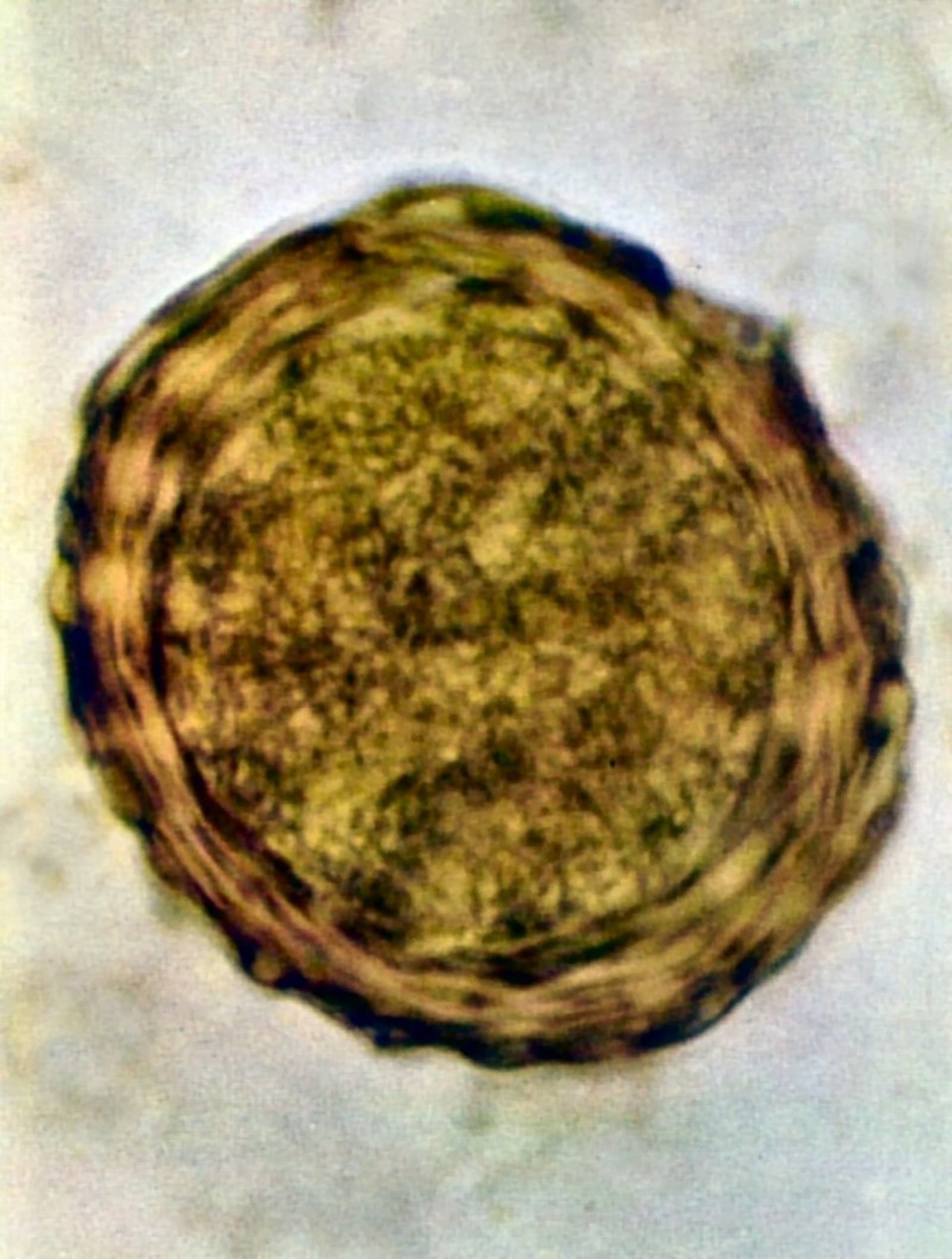 Škrkavka dětská (vajíčko) vytažená z lidského výkalu