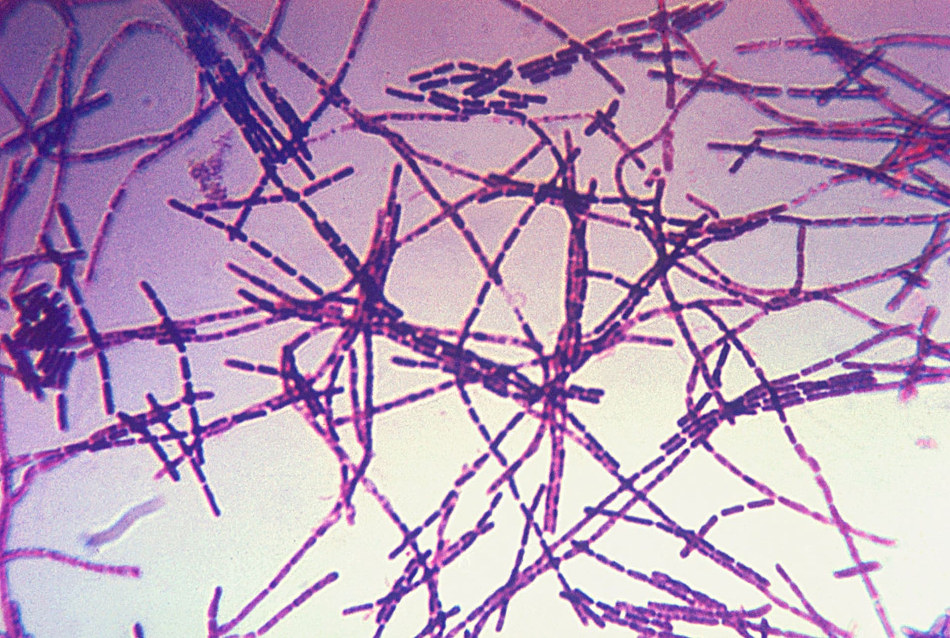 Bakterie Bacillus anthracis