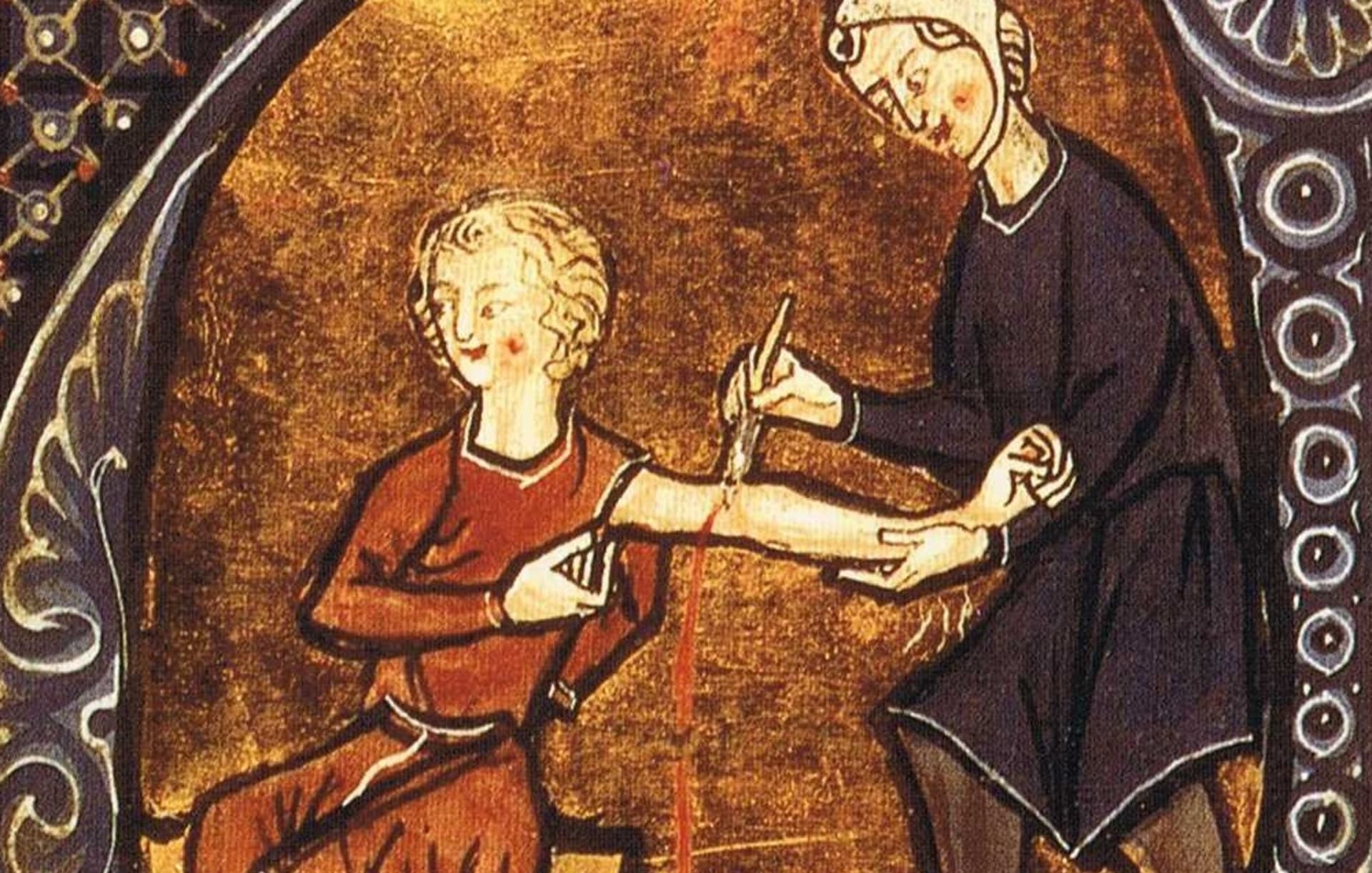 Středověké pouštění žilou