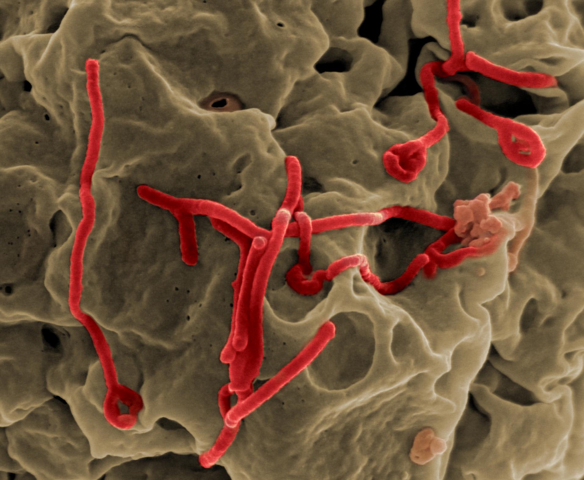 Detail viru ebola