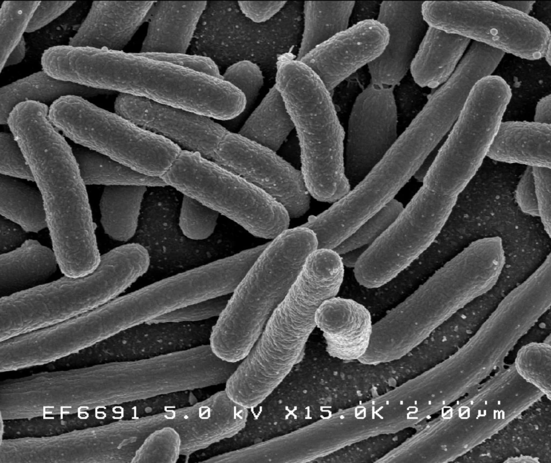 Střevní bakterie Escherichia coli