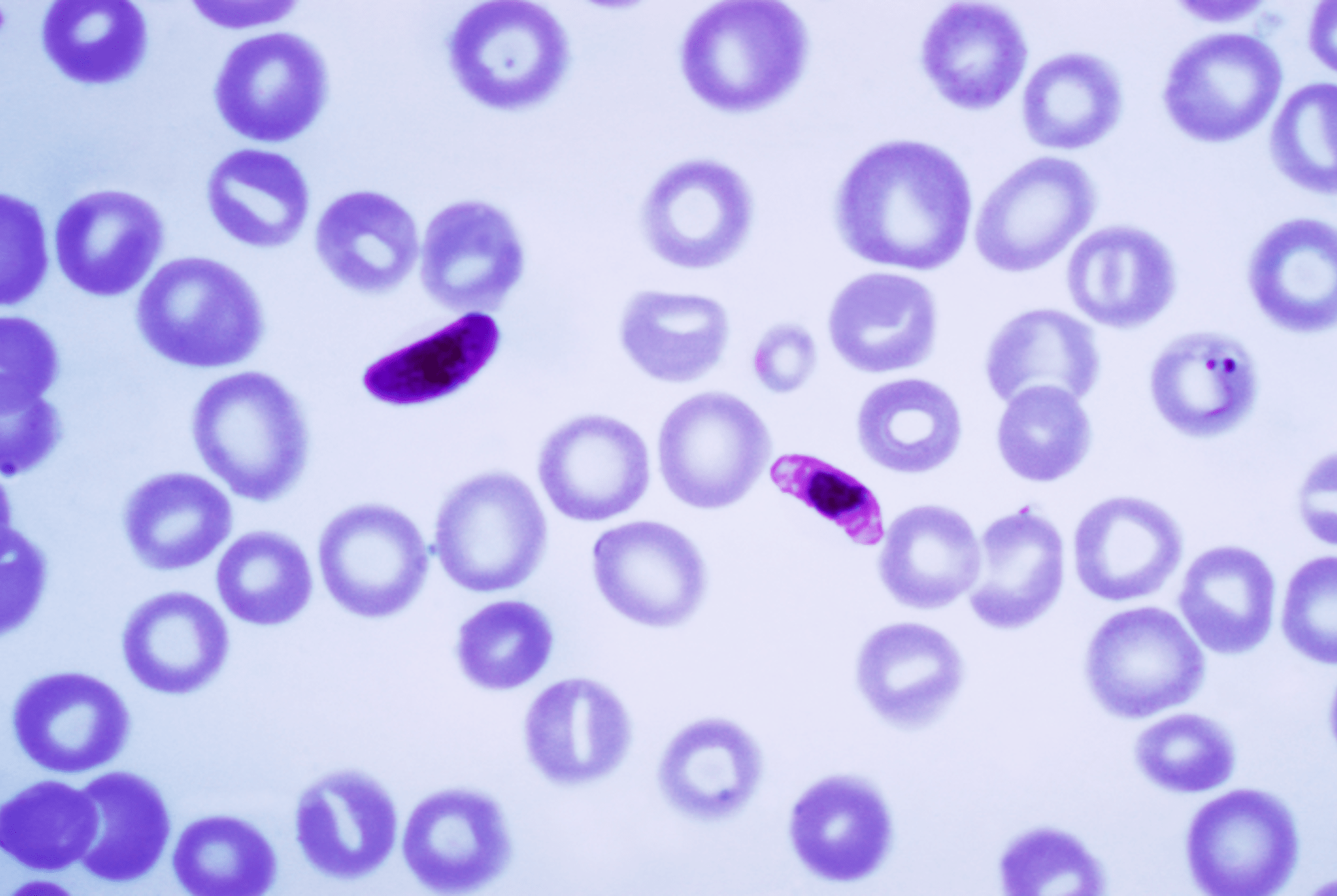 Plasmodium falciparum - parazit způsobující malárii