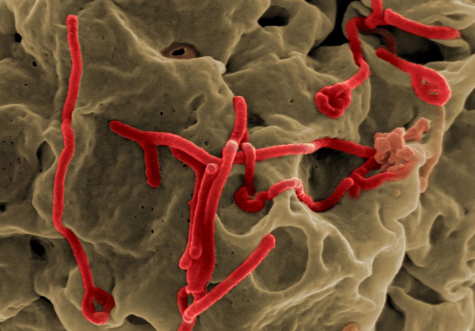 Ebola na makrofotografii
