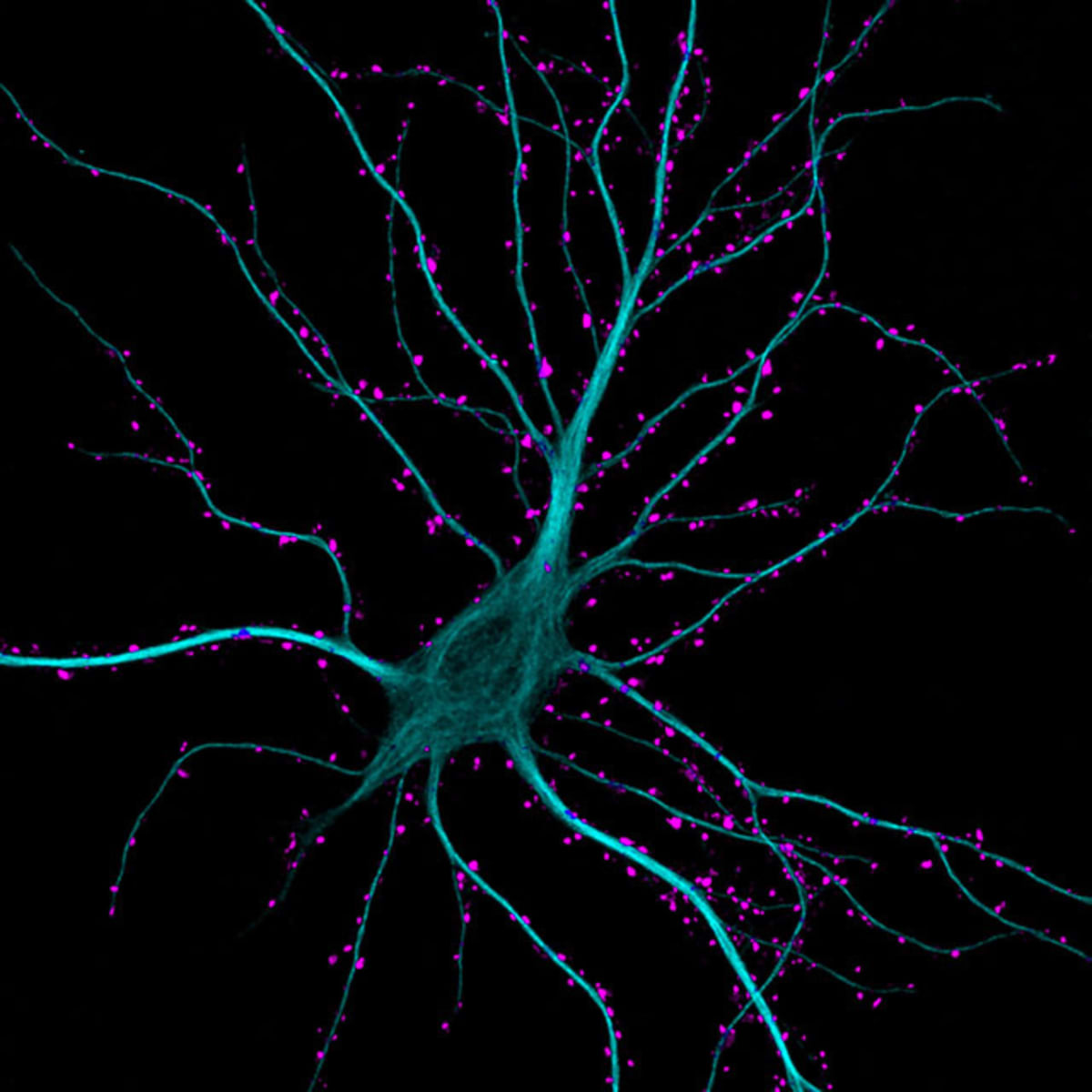 Neurony