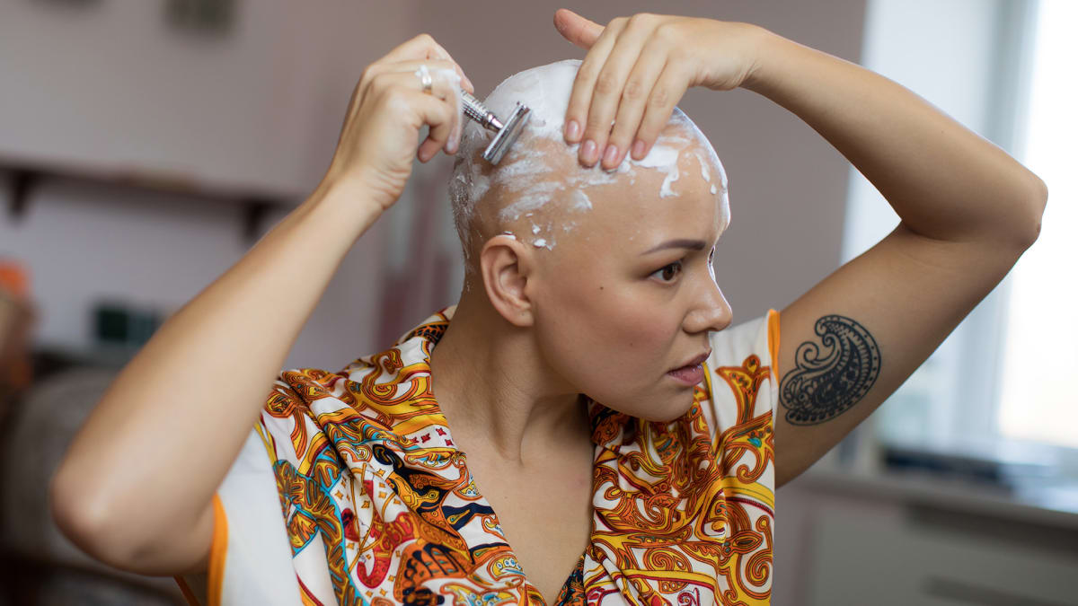 Alopecie vede ke ztrátě vlasů