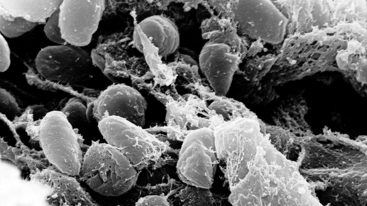 Původce moru – bakterie Yersinia pestis