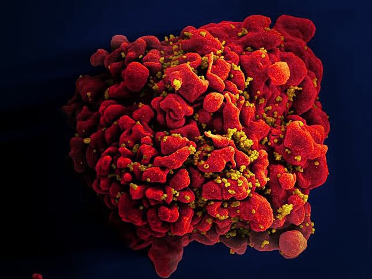 Ukázka viru HIV