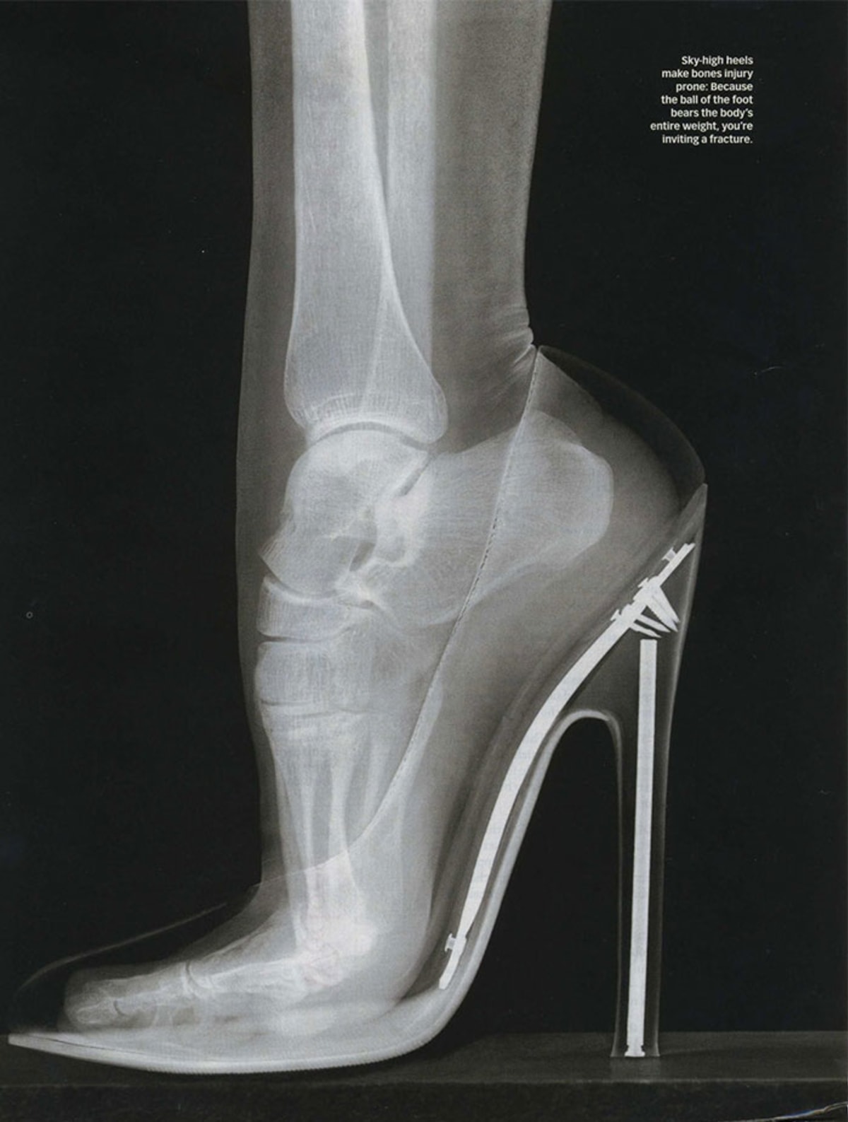 I v porovnání se snímkem baletčiny nohy se klasické boty na podpatku zdají jako mučicí nástroj ze středověku