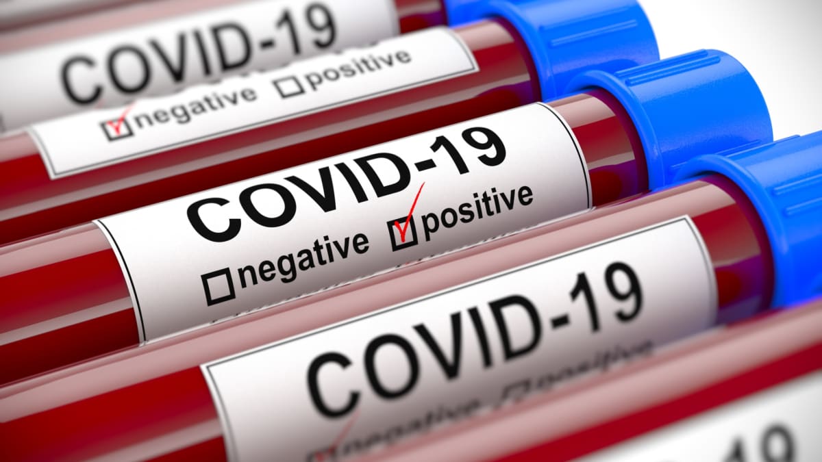 Testování na COVID-19 může probíhat i rektálně