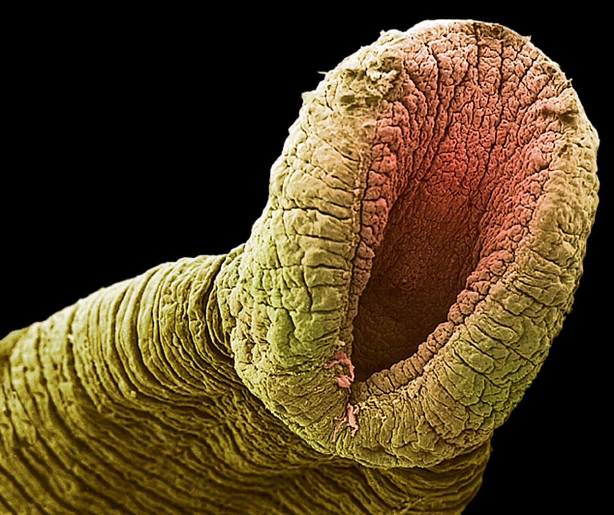 Pod mikroskopem: pijavice