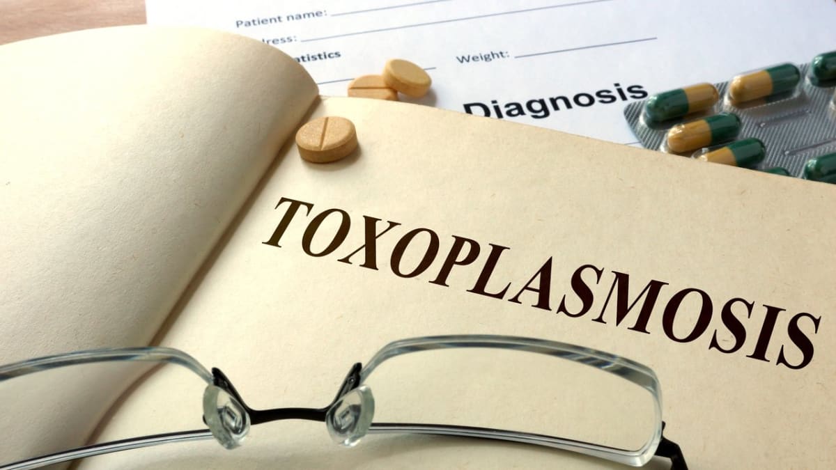 třetina české populace je nakažena toxoplazmózou