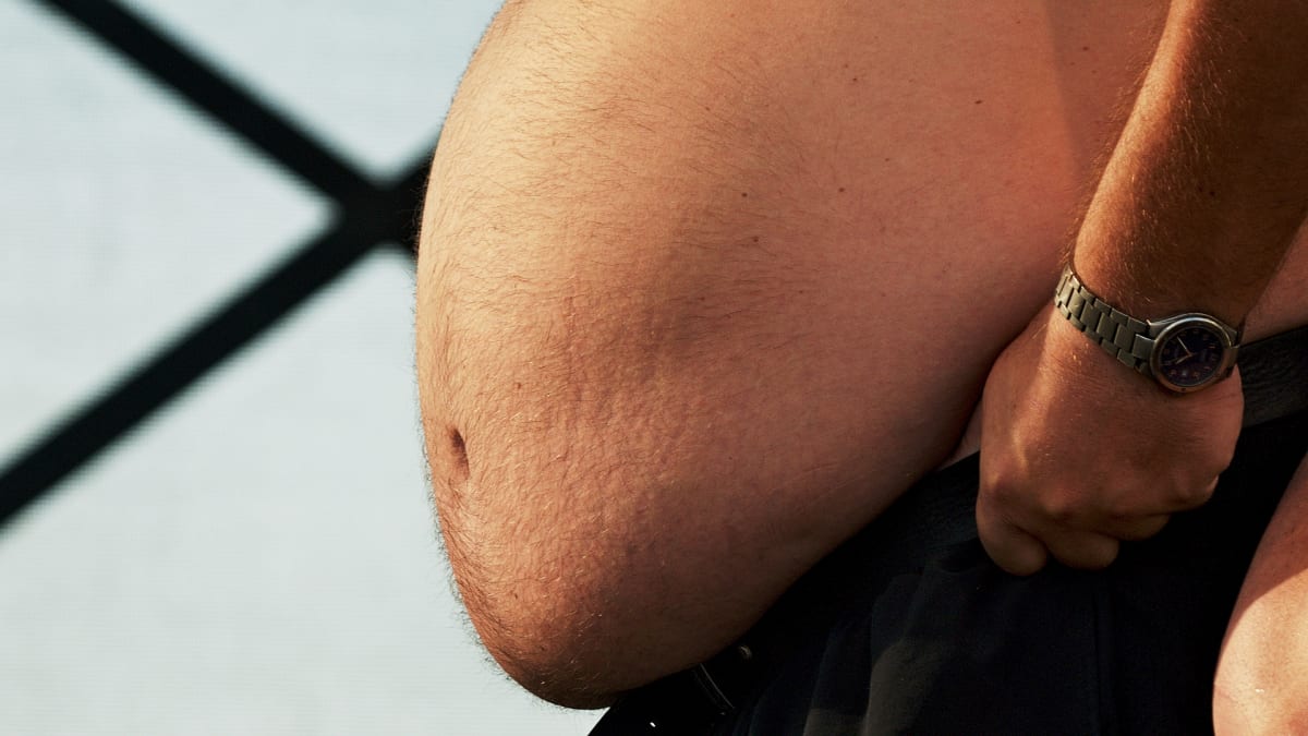 V Česku dál trvá pandemie obezity