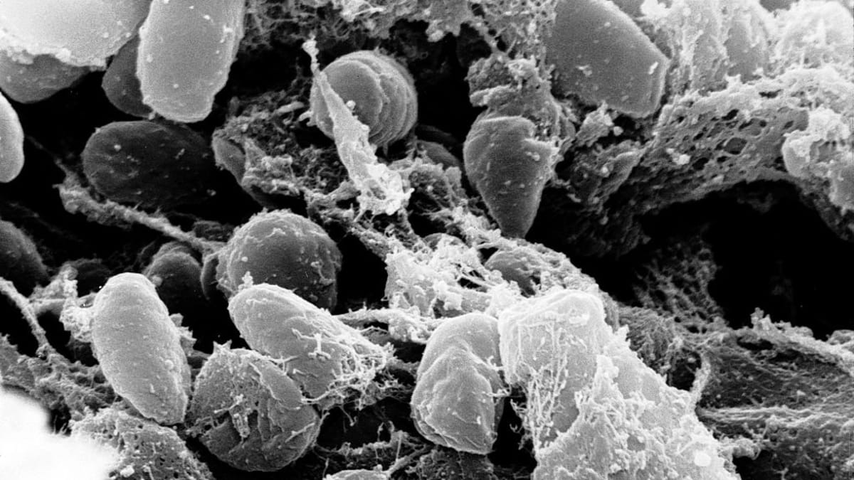 Původce moru - bakterie Yersinia pestis