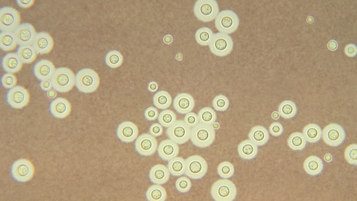 Mikroskopické houby druhu Cryptococcus neoformans (zde obarvené světlým indickým inkoustem)