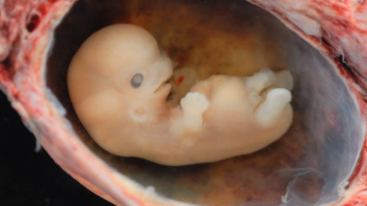 Osmitýdenní lidské embryo