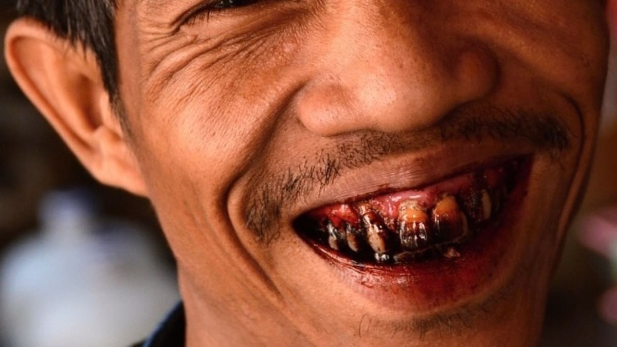 Betelové zuby