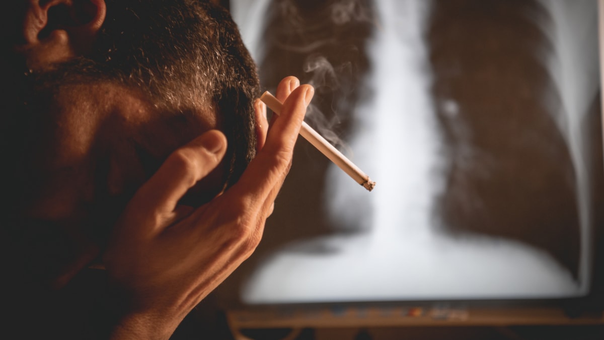 Rakovina plic je diagnóza, která děsí většinu kuřáků