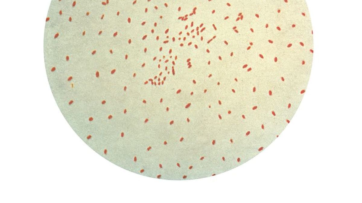 Bakterie černého kašle - Bordetella pertussis