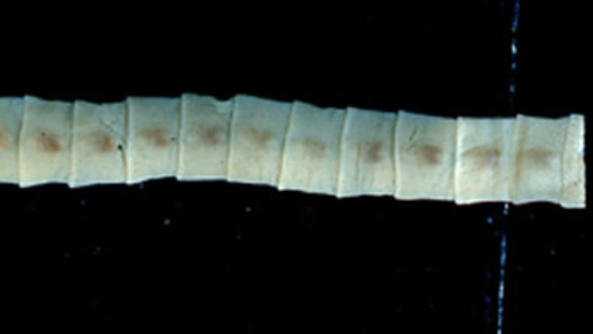 Škulovec široký (Dibothriocephalus latus)