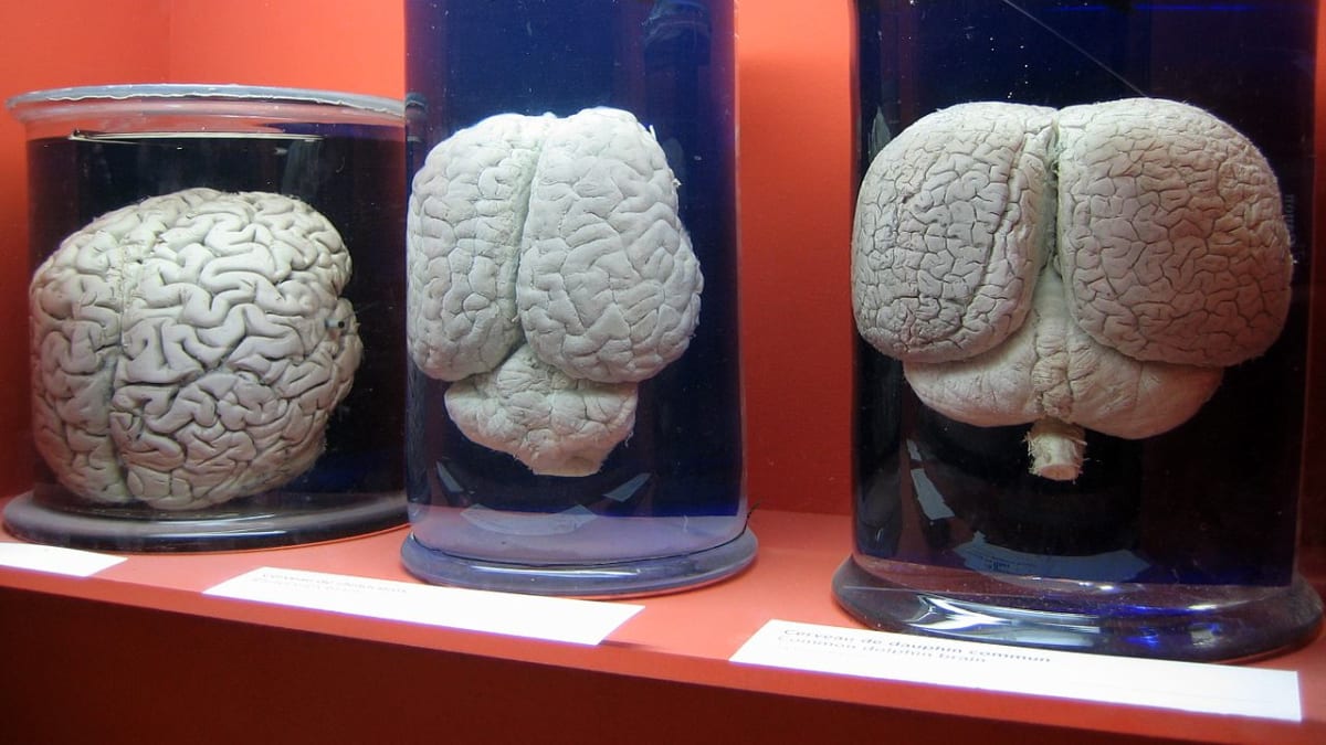 mozek člověka - nosorožce a delfína