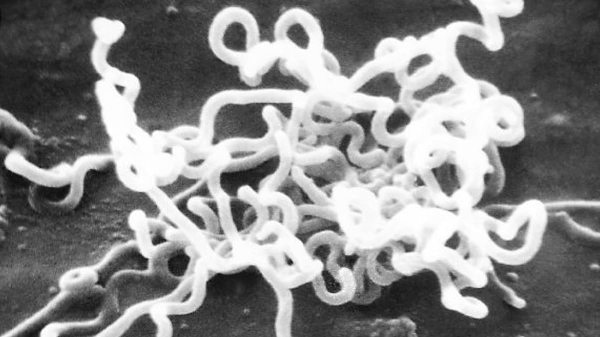 Treponema pallidum - původce syfilis