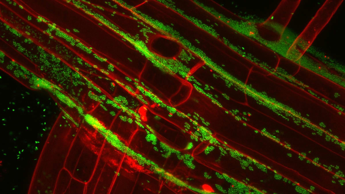 Fluorescenční mikroskopie bakterií na kořenech rostlin